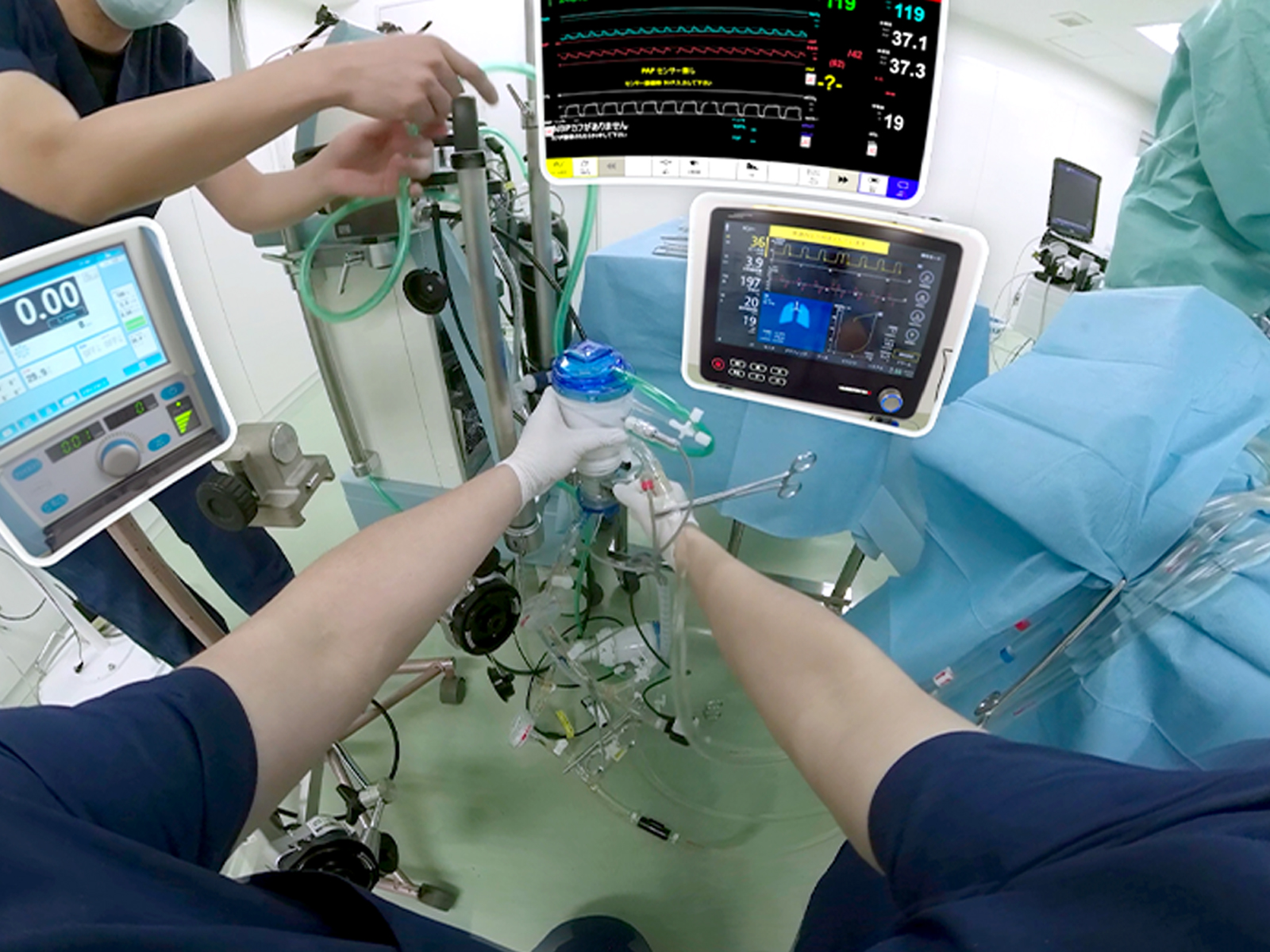 医療VR教材と医療機器ECMOをセット販売開始！